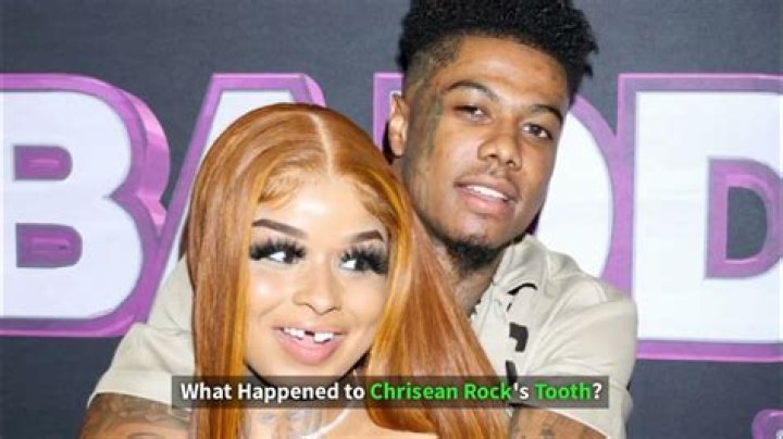 HHow Did Chrisean Rock Lose Her Tooth? The Shocking Truth Behind the Rapper’s Missing Smile