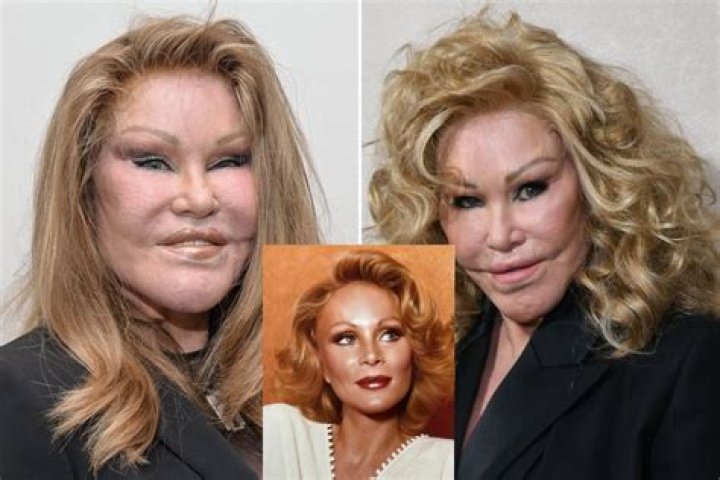 Jocelyn Wildenstein Before And After Plastic Surgery Young Photos- Where Is She Now? ·