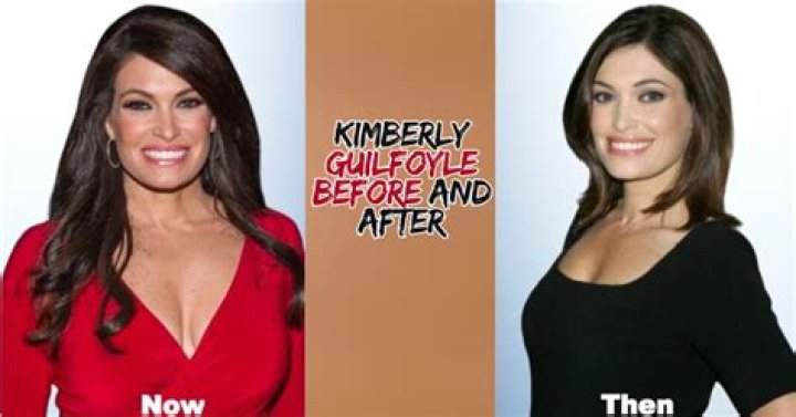 Kimberly Guilfoyle Before Surgery, Young Photos Age And Husband Revealed