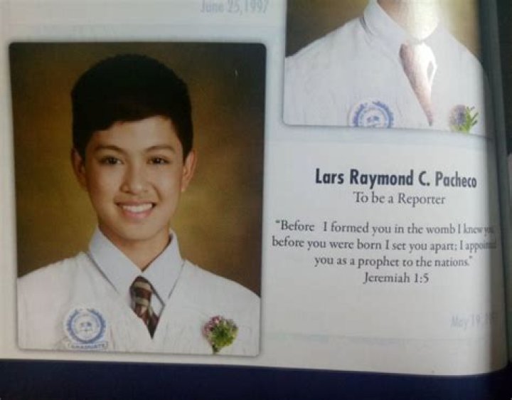 Lars Pacheco Before And After Surgery Pics, Gender Age And Family Explored