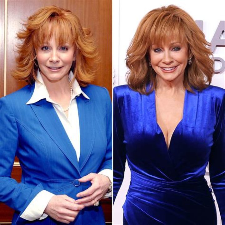 Reba Mcentire | Plastic Surgery | Before And After