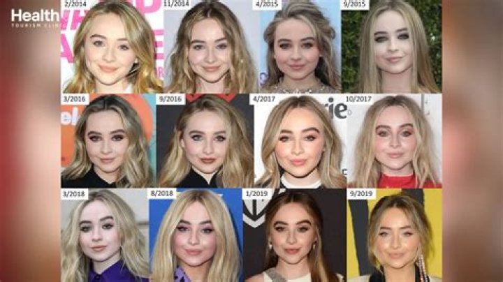 Sabrina Carpenter's Plastic Surgery Rumors: Fact Or Fiction?