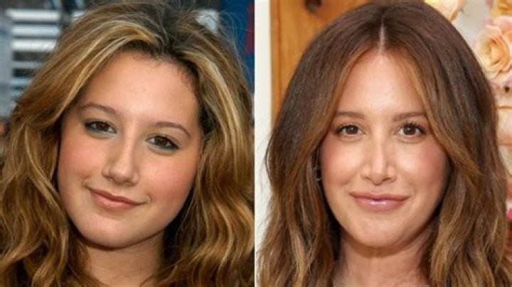 Uncover The Secrets Of Ashley Tisdale's Iconic Nose