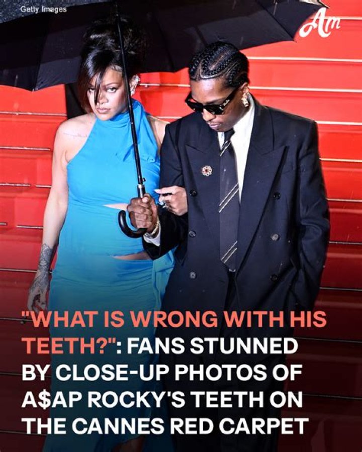 What Is Wrong With His Teeth?